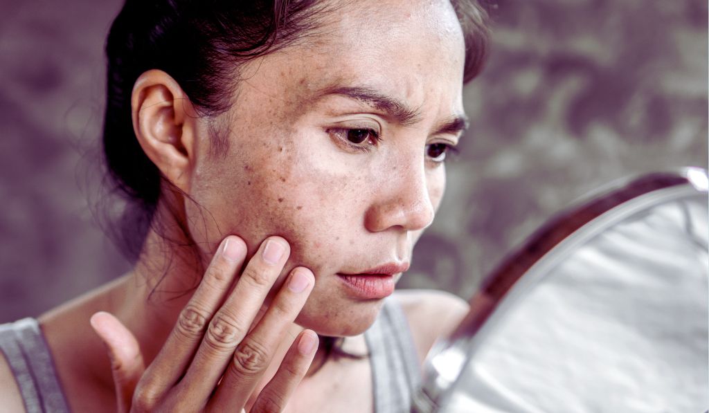 Dangerous Skincare Chemicals 10 Harmful Ingredients That Damage Your Skin in 2025